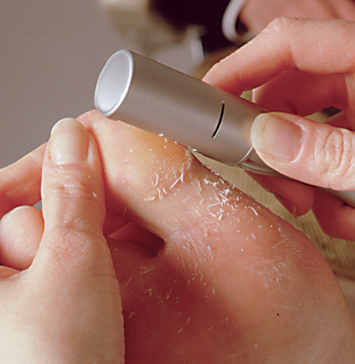 Bentlon Omnicut, fræser til beskæring