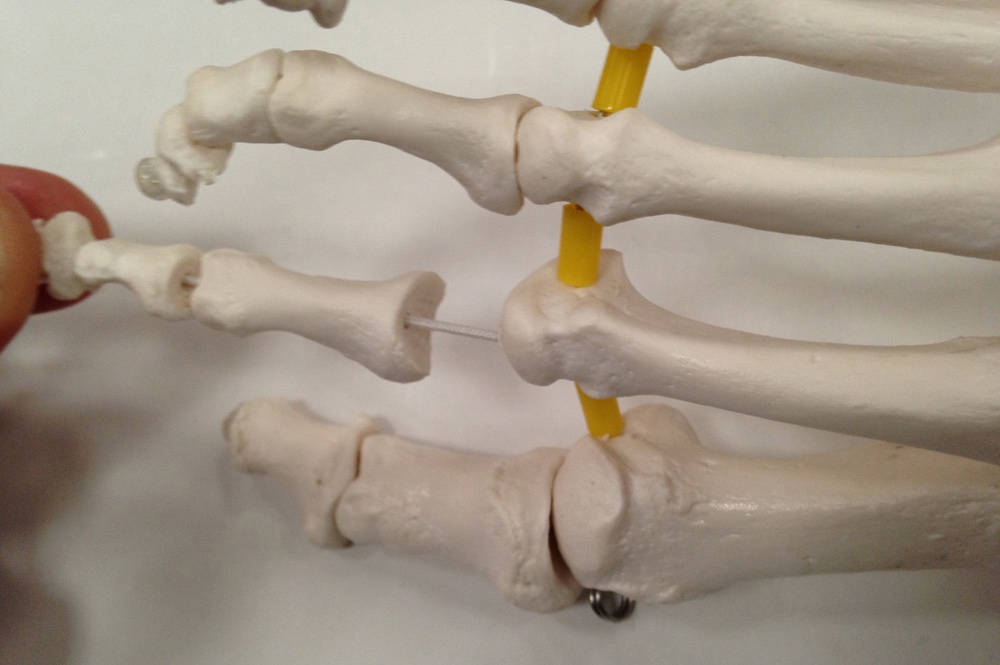 Knoglefod med elastik, Nummereret