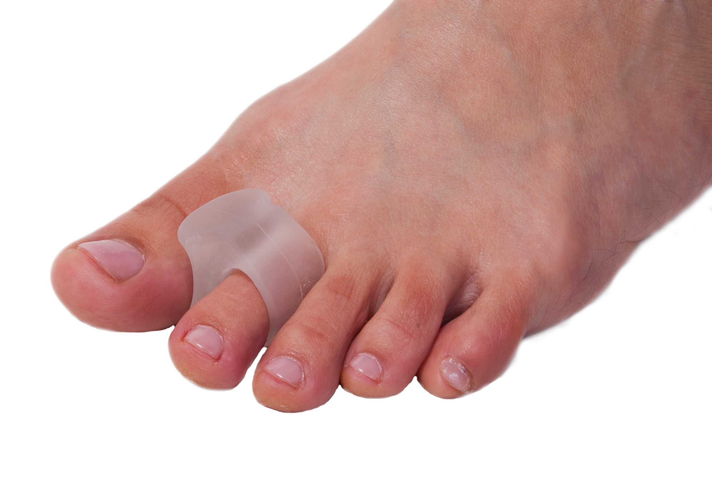 Gelsmart, Tåskiller Med Tåring