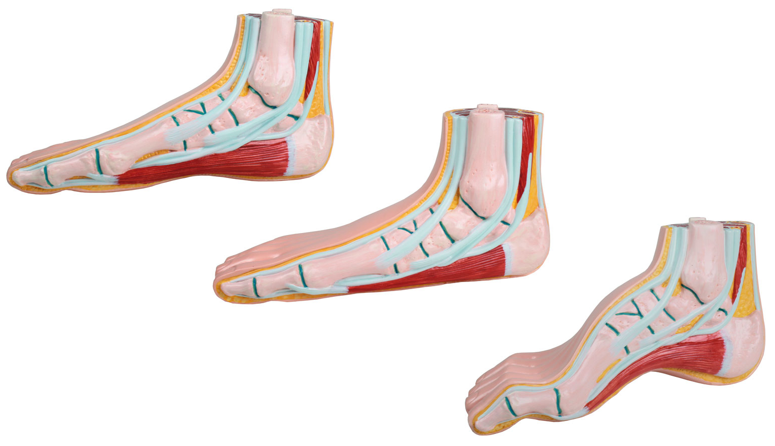 Modelfødder, Mini, Normal fod, Hulfod, Fladfod