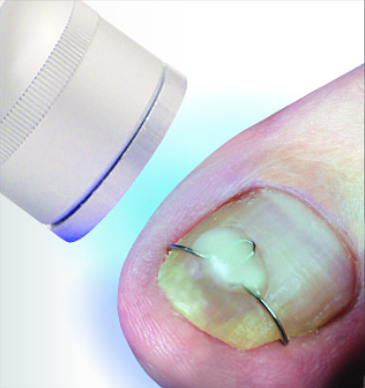 Unguisan, Blue Light, Standard Gel, 3 ml.