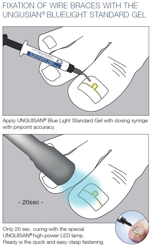 Unguisan, Blue Light, Standard Gel, 3 ml.