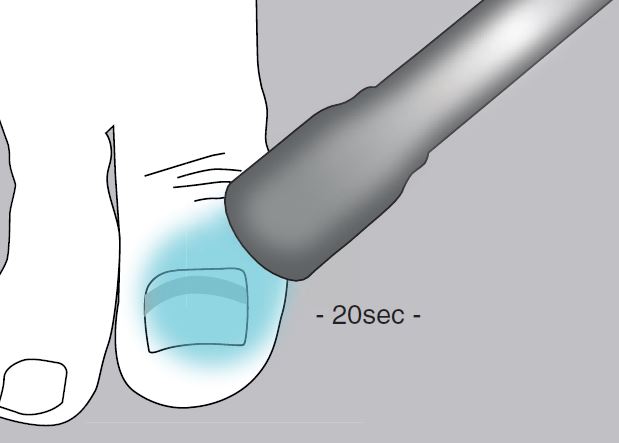 Unguisan, Composit, Hard