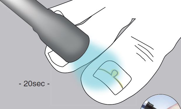 Unguisan, Blue light, LED Lampe
