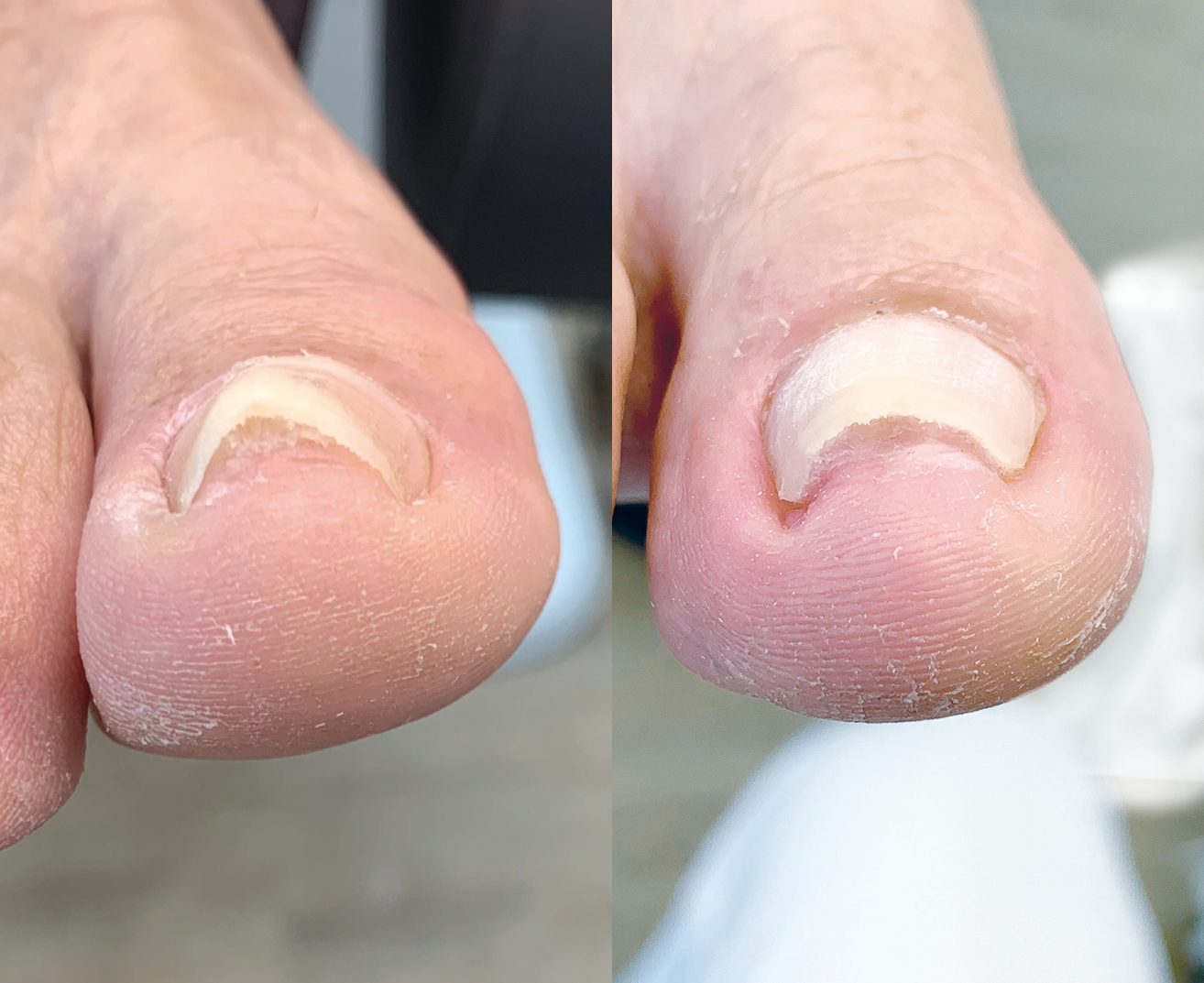 Unguisan, Composit, Hard