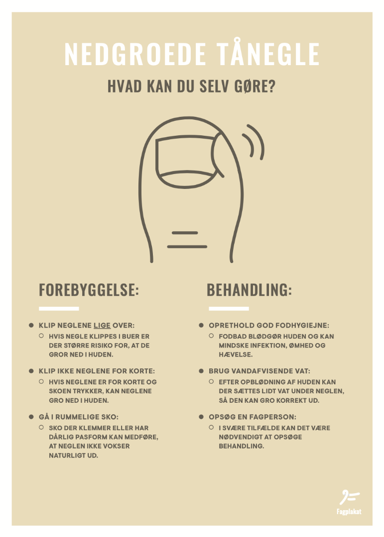 Fagplakat, Nedgroede tånegle, 50x70 cm.