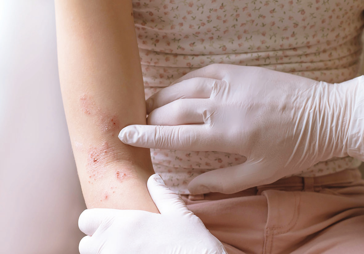 Callusan, skumcreme, Verde